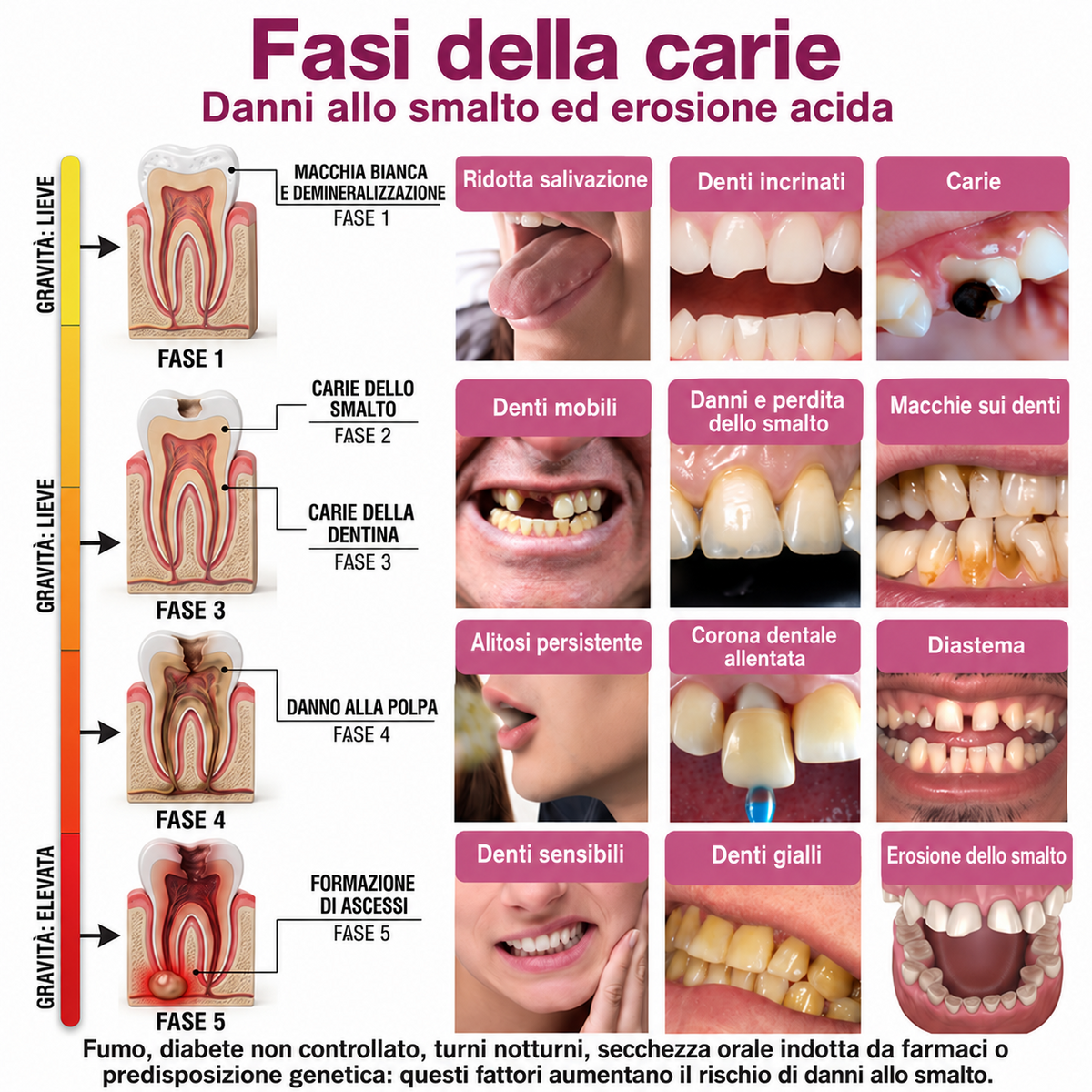 Glimmerly®💐💖Gel per la riparazione di cavità dentali DenPerm – Otturazione che riproduce lo smalto naturale