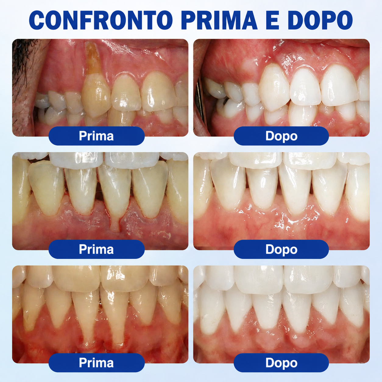 🪻💖 𝑮𝒍𝒊𝒎𝒎𝒆𝒓𝒍𝒚®🦷𝑮𝒖𝒎𝑹𝒆𝒗𝒊𝒗𝒆 𝑮𝒆𝒍 𝑷𝒂𝒓𝒐𝒅𝒐𝒏𝒕𝒂𝒍𝒆 𝑹𝒊𝒈𝒆𝒏𝒆𝒓𝒂𝒏𝒕𝒆