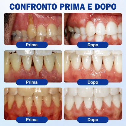 🪻💖 𝑮𝒍𝒊𝒎𝒎𝒆𝒓𝒍𝒚®🦷𝑮𝒖𝒎𝑹𝒆𝒗𝒊𝒗𝒆 𝑮𝒆𝒍 𝑷𝒂𝒓𝒐𝒅𝒐𝒏𝒕𝒂𝒍𝒆 𝑹𝒊𝒈𝒆𝒏𝒆𝒓𝒂𝒏𝒕𝒆