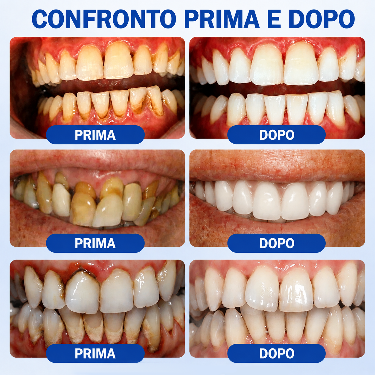 🪻💖 𝑮𝒍𝒊𝒎𝒎𝒆𝒓𝒍𝒚®🦷𝑮𝒖𝒎𝑹𝒆𝒗𝒊𝒗𝒆 𝑮𝒆𝒍 𝑷𝒂𝒓𝒐𝒅𝒐𝒏𝒕𝒂𝒍𝒆 𝑹𝒊𝒈𝒆𝒏𝒆𝒓𝒂𝒏𝒕𝒆